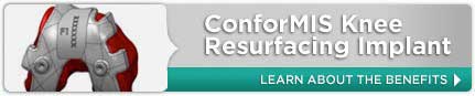 ConforMIS Knee Resurfacing Implant. Learn about the benefits